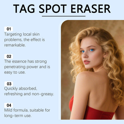 Vcoxno™ Botanical Spot & Tag Precision Roll Pen