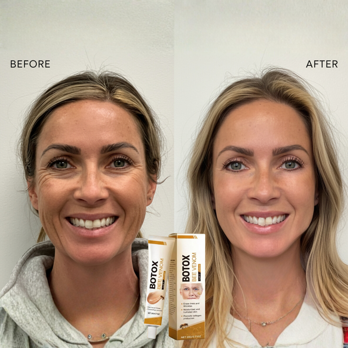 Vcoxno™ Bee Venom Youth Cream