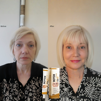 Vcoxno™ Bee Venom Youth Cream