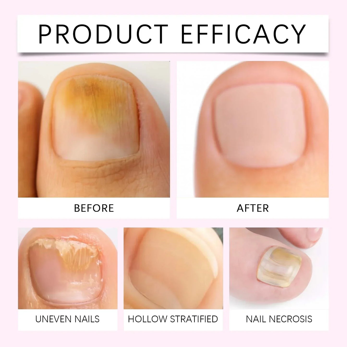 2-in-1 Cuticle Pusher Oil Pen