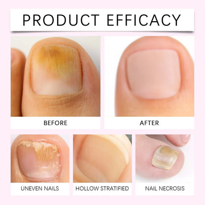 2-in-1 Cuticle Pusher Oil Pen