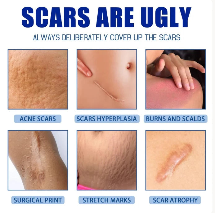 Smooth & Improve the Appearance of Scars