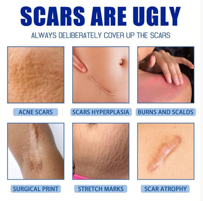 Smooth & Improve the Appearance of Scars