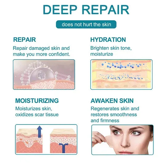 Advanced Scar Spray For All Types of Scars - For example Acne Scars, Surgical Scars and Stretch Marks ⚡️⚡️⚡️