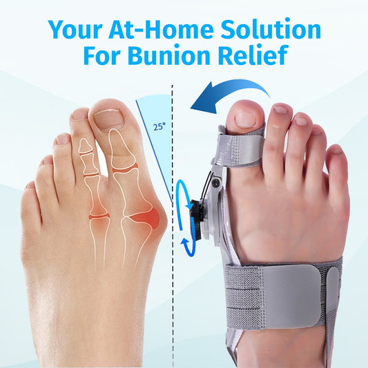 Bunion Corrector – Adjustable Toe Alignment Support for Daily Comfort