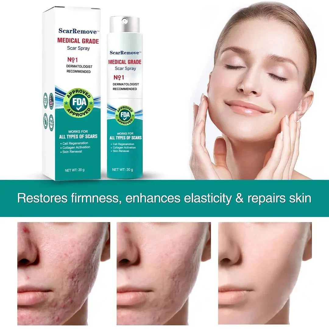 Advanced Scar Spray For All Types of Scars - For example Acne Scars, Surgical Scars and Stretch Marks ⚡️⚡️⚡️
