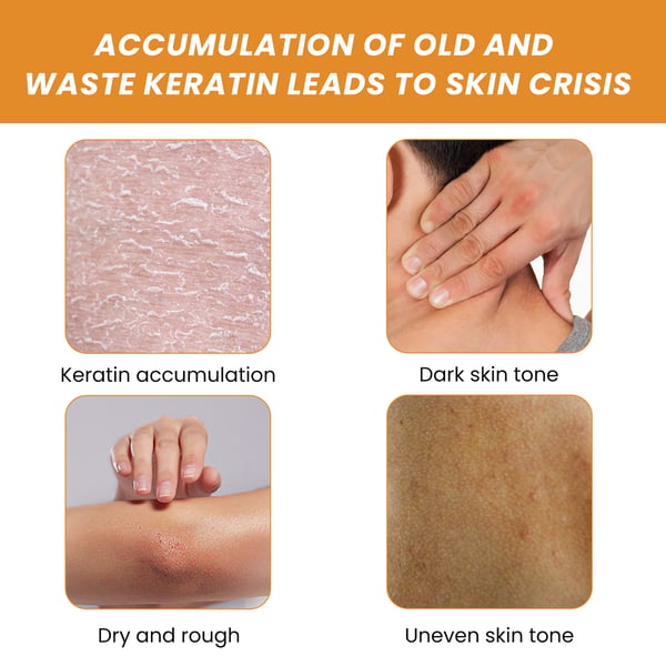 🔥HOT SALE 49% off🔥SKIN WHITENING EXFOLIATING GEL