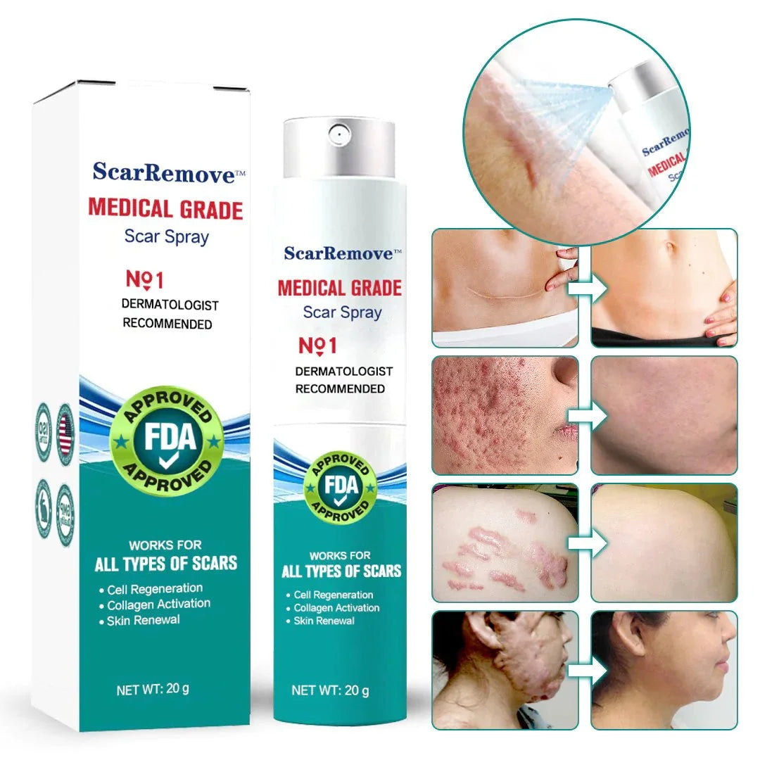Advanced Scar Spray For All Types of Scars - For example Acne Scars, Surgical Scars and Stretch Marks ⚡️⚡️⚡️